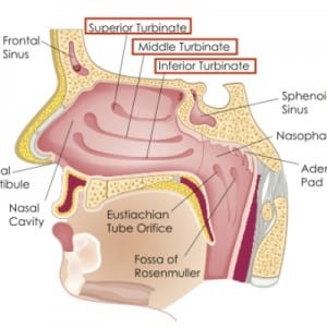 dr-monica-hypertrophic-turbinates