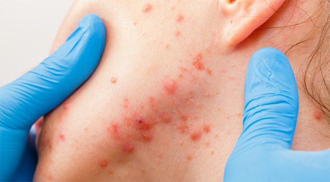 skin allergies treatments