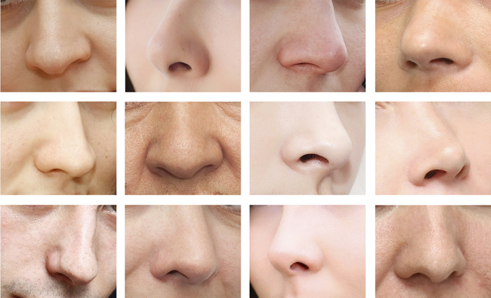 fix a crooked nose with surgery in NJ & NYC