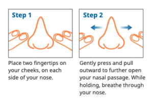 VivAer®️ Non-Surgical Treatment For Nasal Obstruction | Dr. Tadros