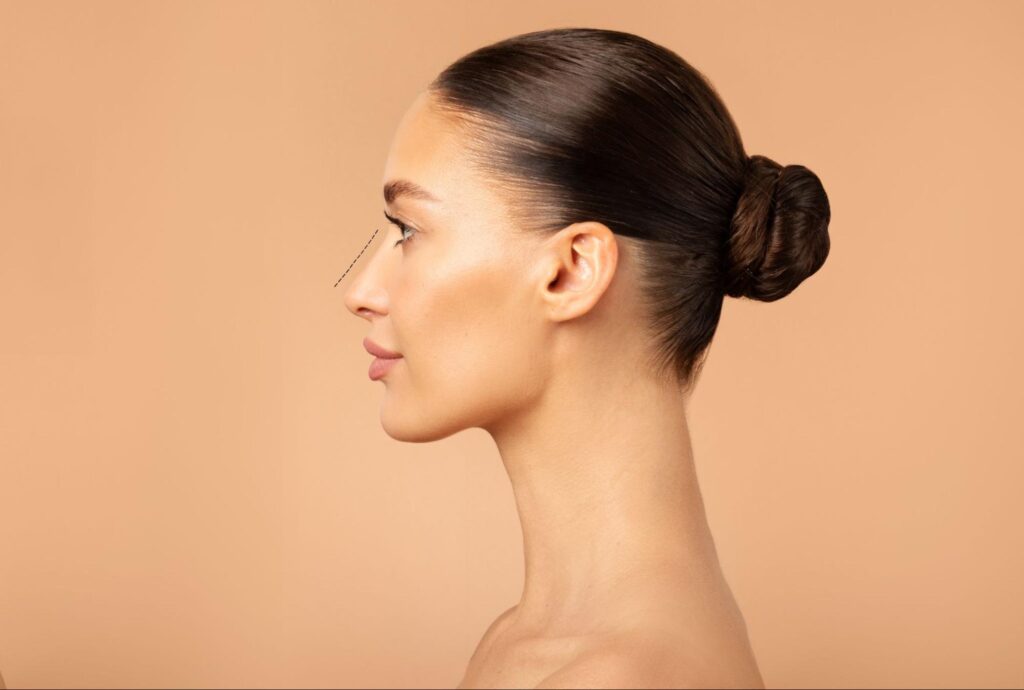Are You an Ideal Candidate for Surgical Rhinoplasty