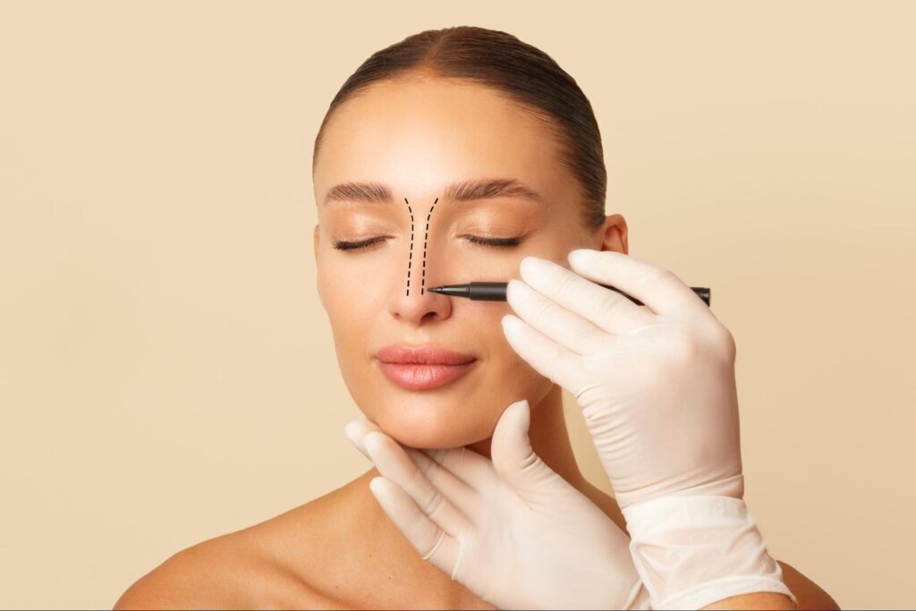 Are You an Ideal Candidate for Surgical Rhinoplasty