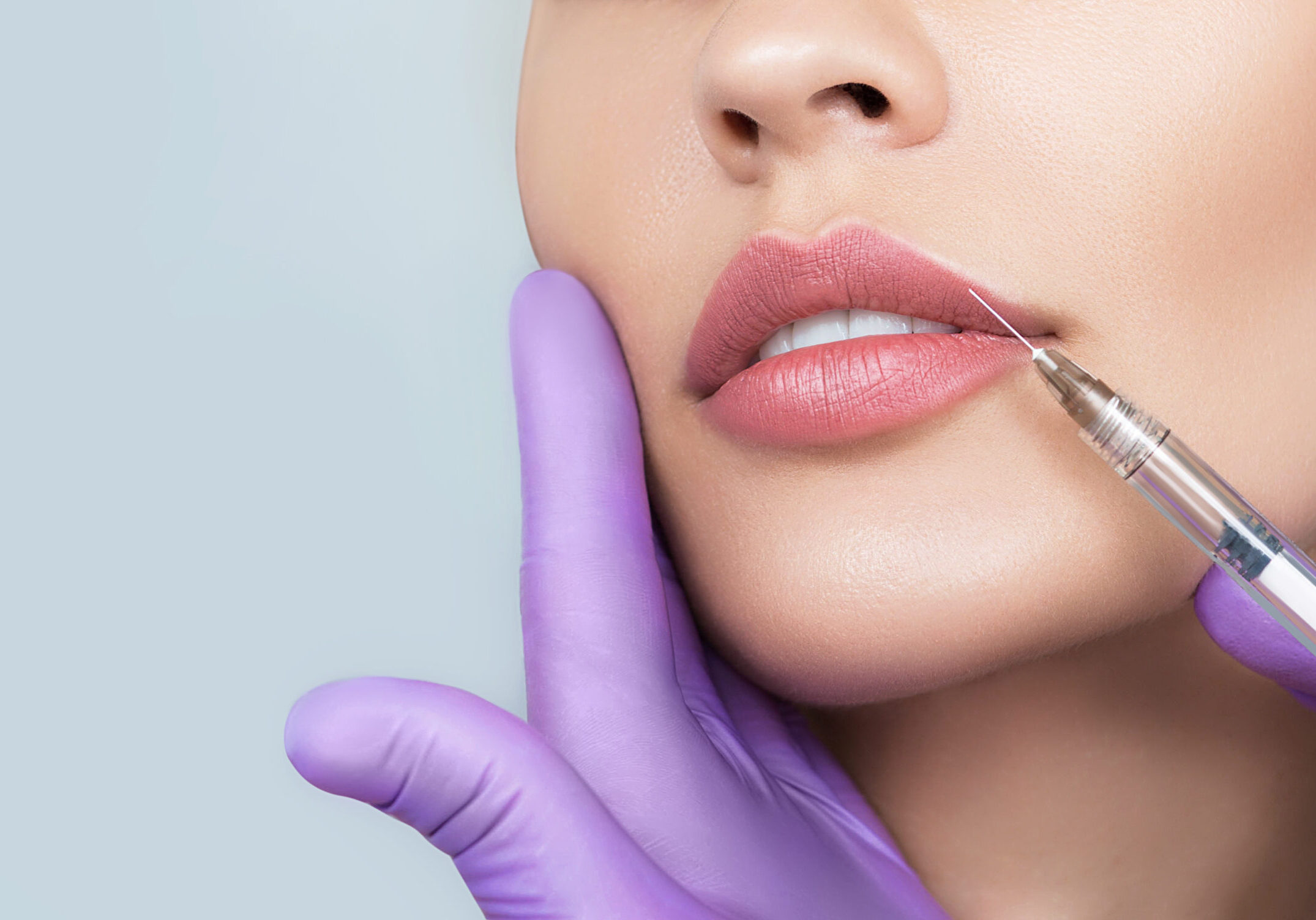 The Truth About Lip Augmentation