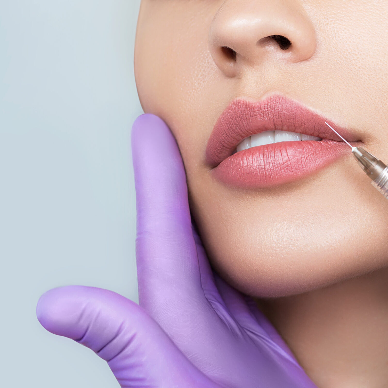 Lip Augmentation in Manhattan