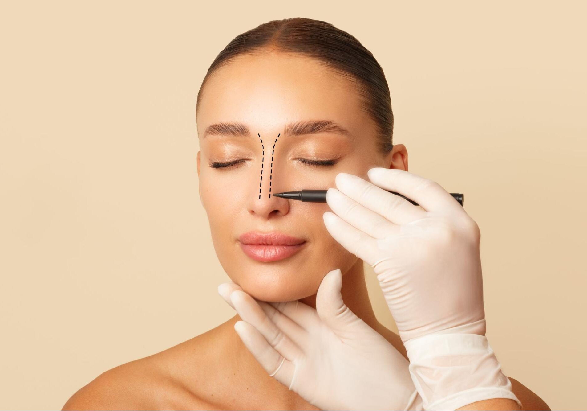 Are You an Ideal Candidate for Surgical Rhinoplasty